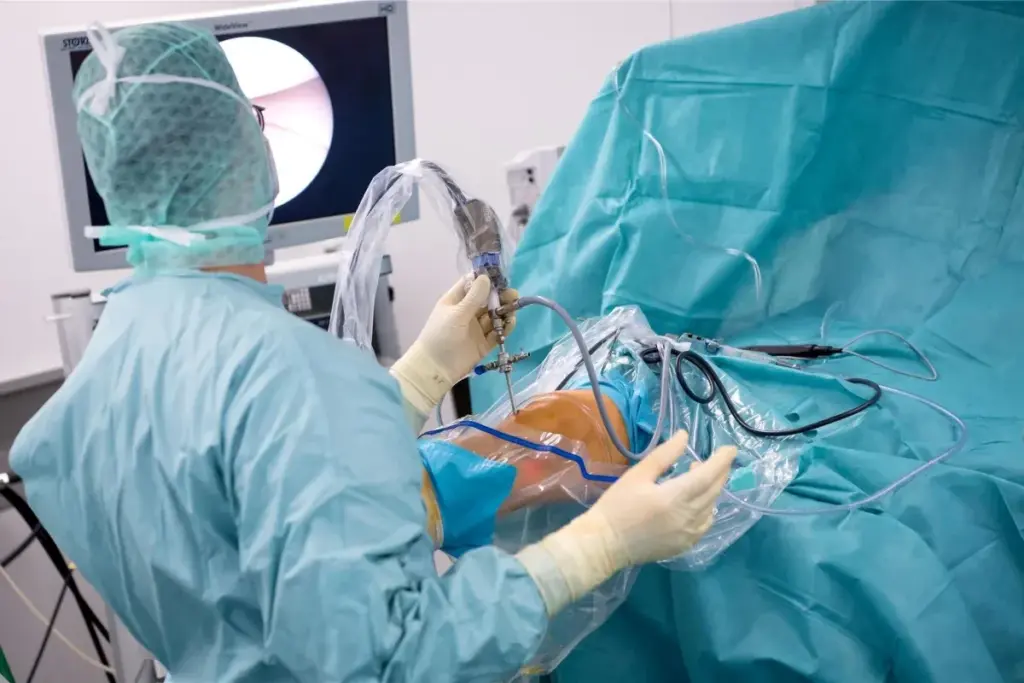 Knee Surgery How Long To Recover: Walk Fast 3 The Immediate Postoperative Period: First 24-48 Hours