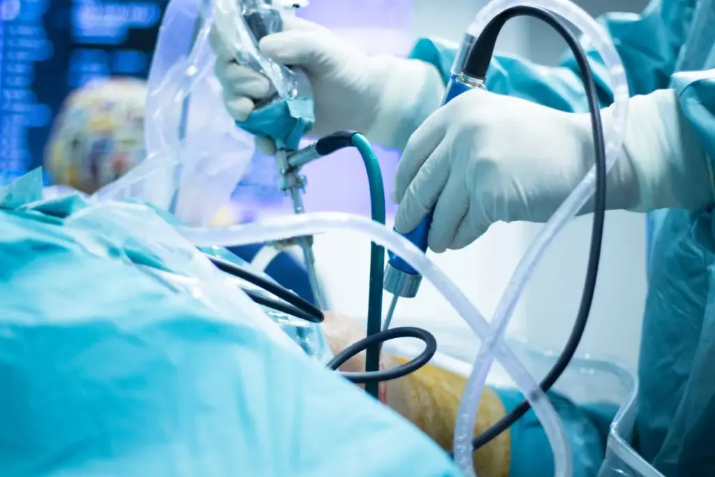 Arthroscopic Knee Surgery Recovery: Best Tips 3 How Long Does Arthroscopic Knee Surgery Take?