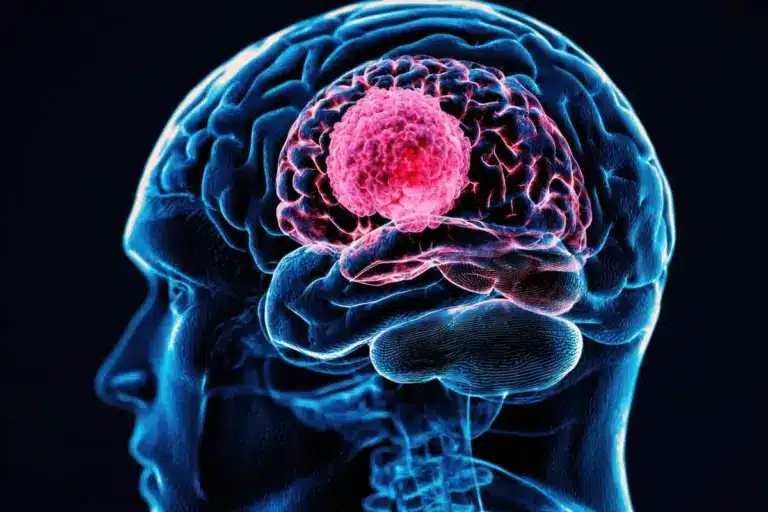 Brain Tumor Symptoms: Amazing Mri Benefits