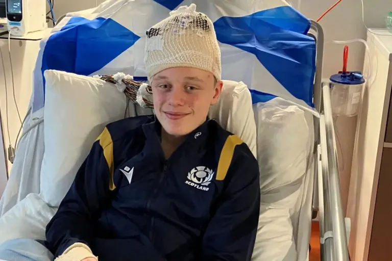 Can Stress Cause Seizures: Amazing Relief