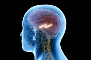 Chiari Malformation: Fatal Risk Awareness