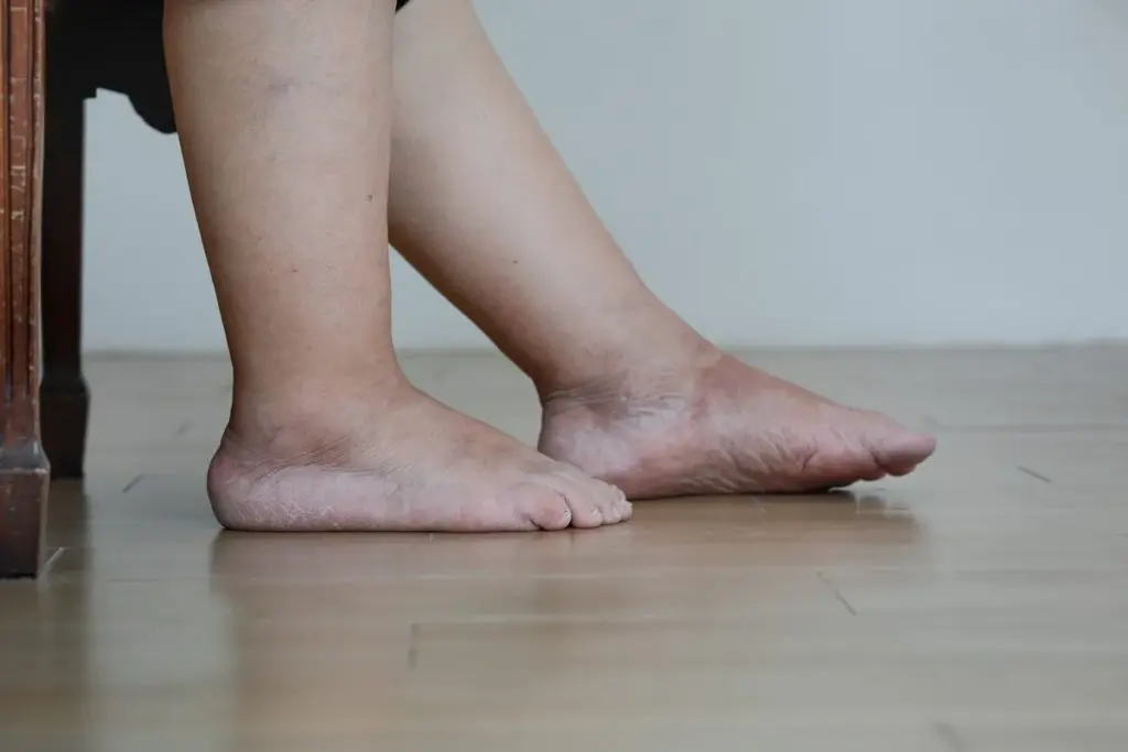 7 Early Signs of Diabetes Feet: Numbness and Tingling Explained