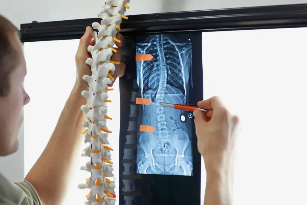 Understanding Scoliosis: Definition and Types