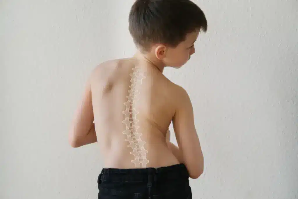 Scoliosis: The Best Time For Permanent Relief