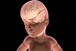 Hydrocephalus Baby: Amazing Life With A Shunt