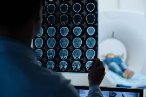 Ct Scan For Concussion: Accurate Testing