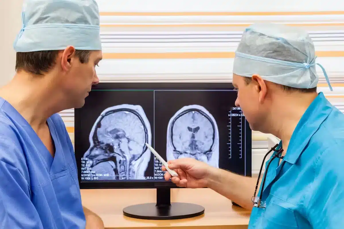 Chiari Malformation: Amazing Elite Surgery Guide