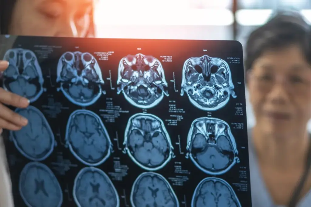 Causes of Congenital Brain Malformations