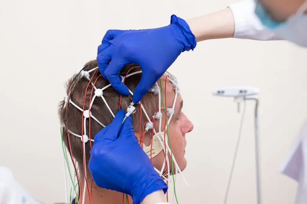 Epilepsy: Amazing Facts About The Root Causes