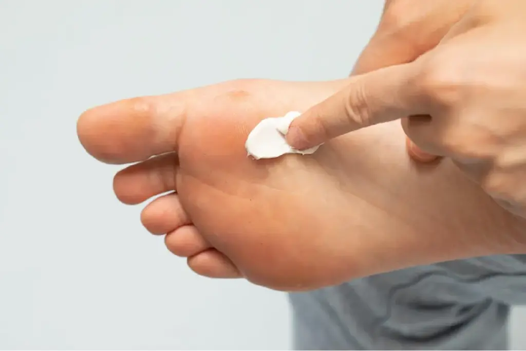 Can Diabetes Cause Heel Pain and Plantar Fasciitis?