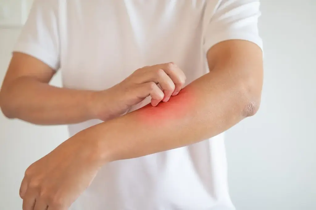 Understanding the Causes of Itchy Roof of Mouth