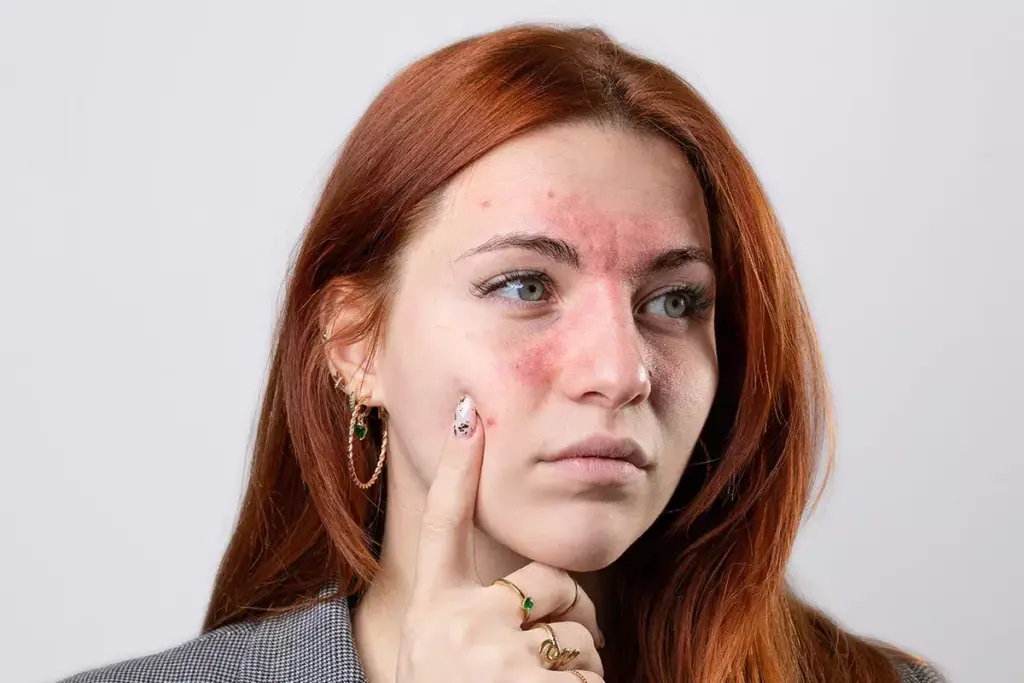 Pins and Needles in Nose and Face: Common Causes