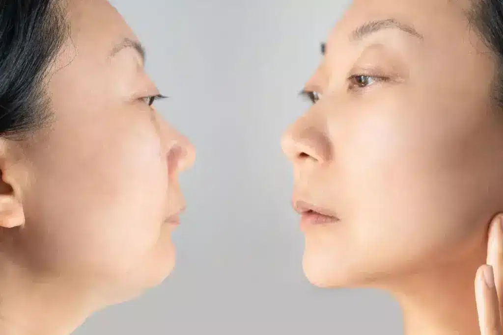 When to Worry About Jawline Swelling