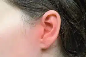 How to Treat Itchy Outer Ears: Relief Guide