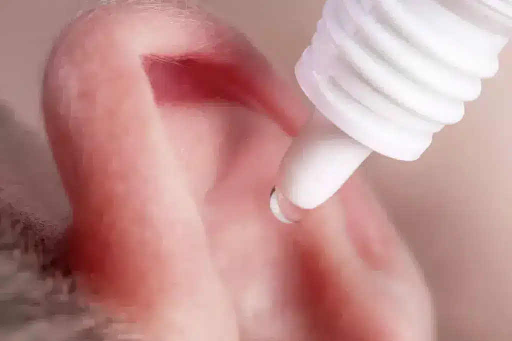 Understanding Otitis Media with Effusion