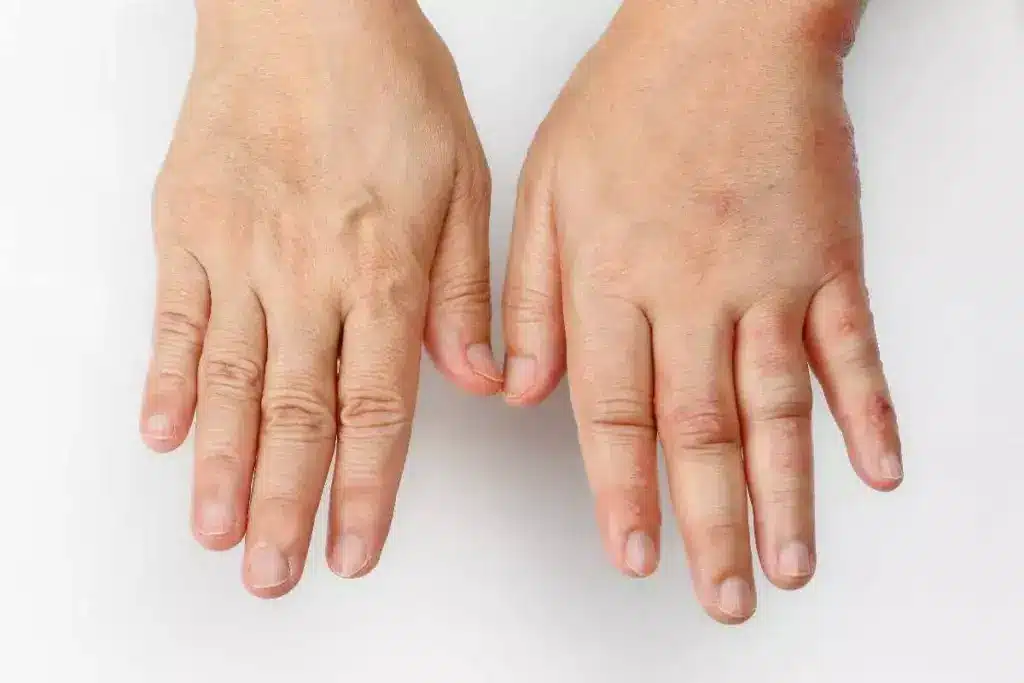 Swollen Hands and Rash All Over Body: What Is It?