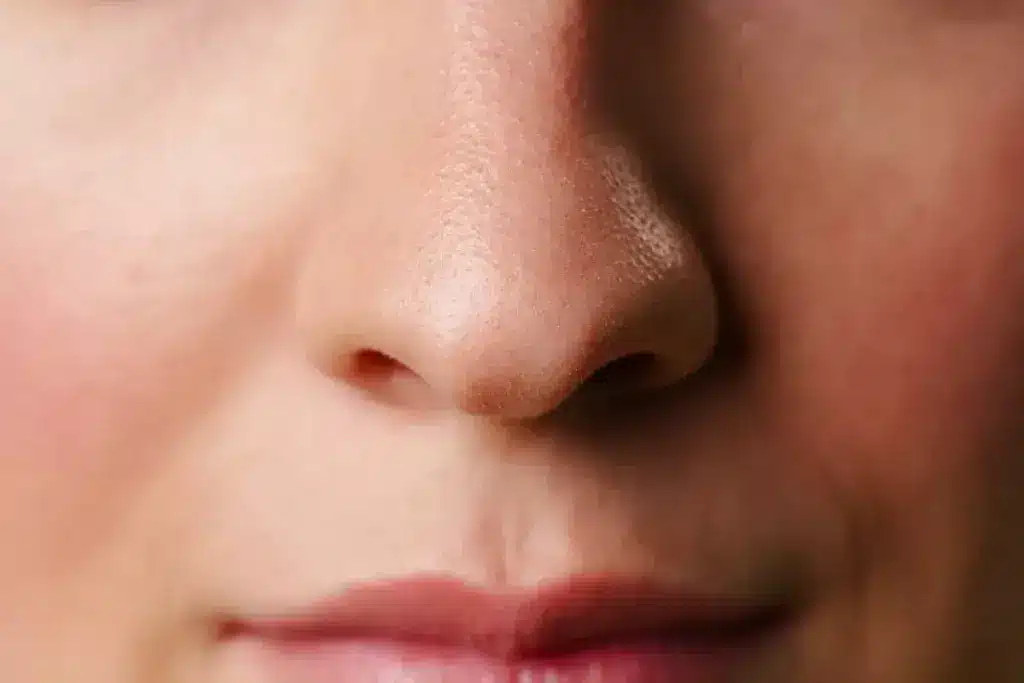 How to Stop Itchy Nostrils: 5 Quick Remedies 3 How to Stop Itchy Nostrils: 5 Quick Remedies