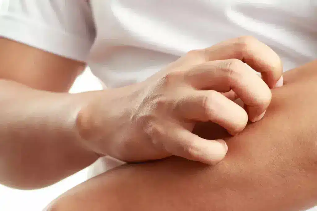 5 Best Antihistamines for Itching Skin: Relief Guide 3 5 Best Antihistamines for Itching Skin: Relief Guide