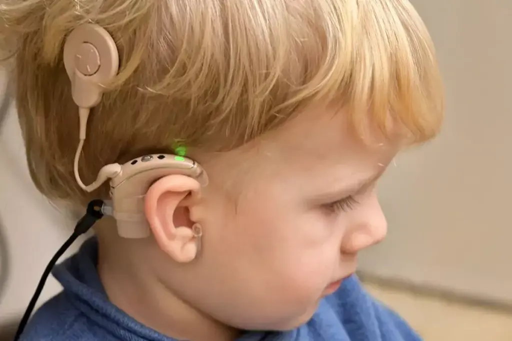 How to Prepare for Cochlear Implant Surgery 2 How to Prepare for Cochlear Implant Surgery