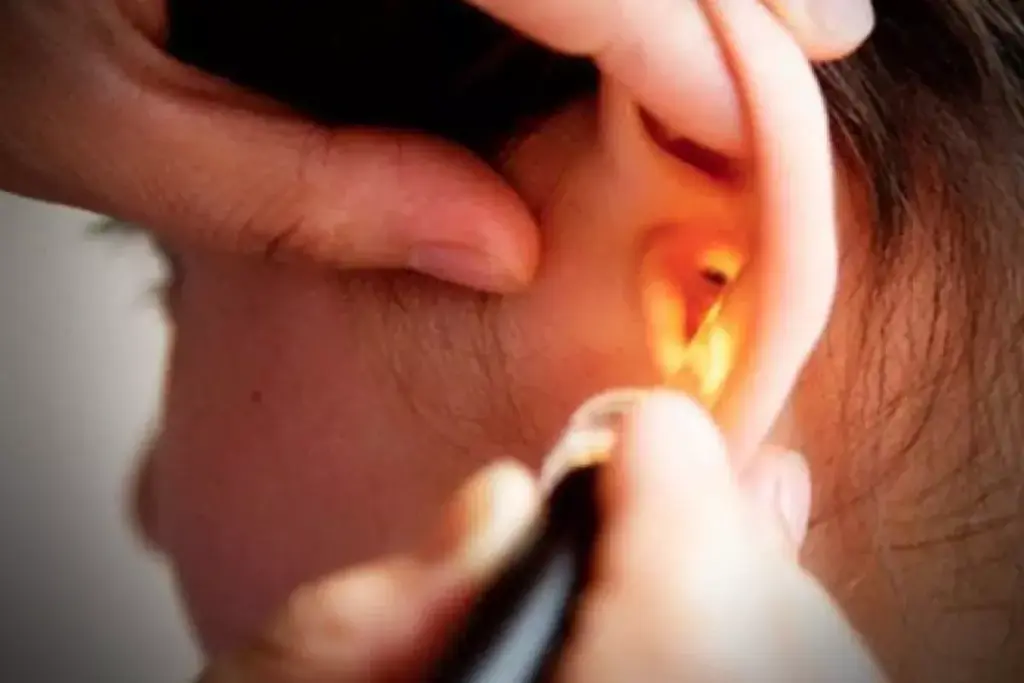 Visual Characteristics of a Healthy Normal Ear Drum