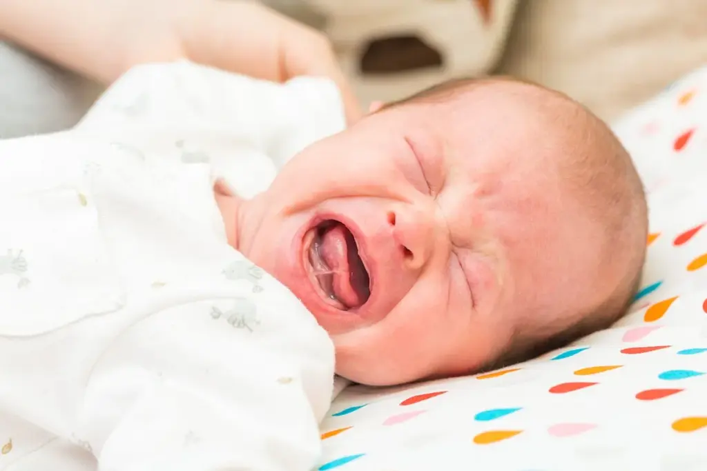 How to Help a Tongue Tied Baby: Self-Care Guide 1 How to Help a Tongue Tied Baby: Self-Care Guide