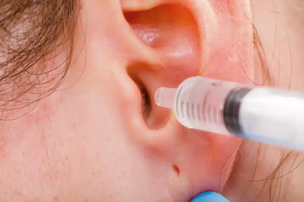 How to Use a Water Ear Cleaner: Complete Guide 3 How to Use a Water Ear Cleaner: Complete Guide