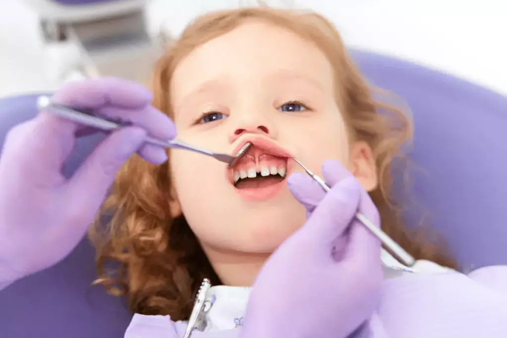 Tongue Tie Symptoms in Newborns: Visual Identification