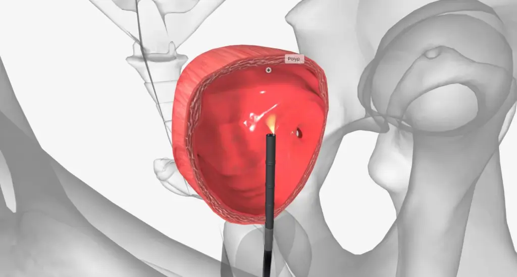 Cystoscope 3 5172 LIV Hospital