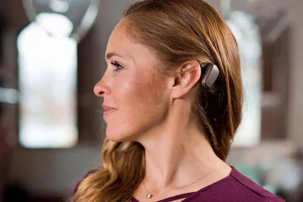 How to Choose the Right Bone Anchored Hearing Aid