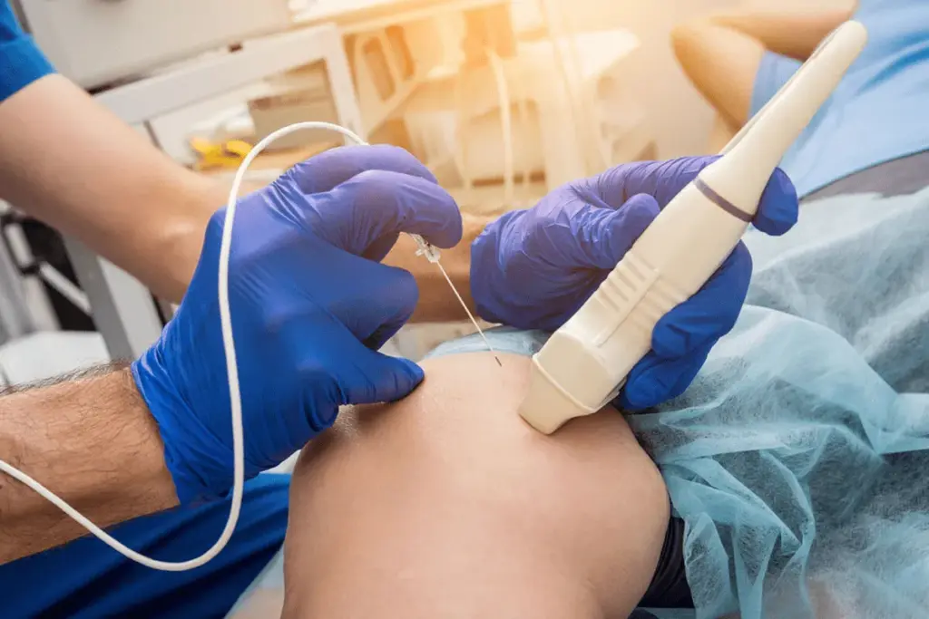 Ablation Definition: Amazing Cancer Fight Facts