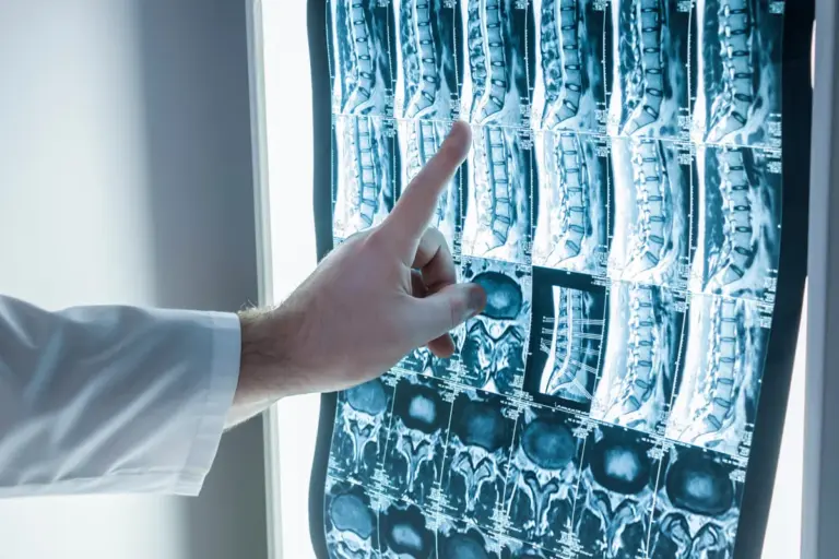 How Long Does It Take To Become An Interventional Neurologist