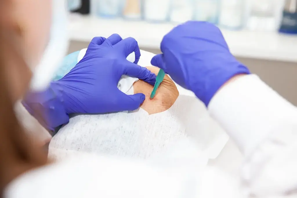 SEP 6735 image 3 LIV Hospital