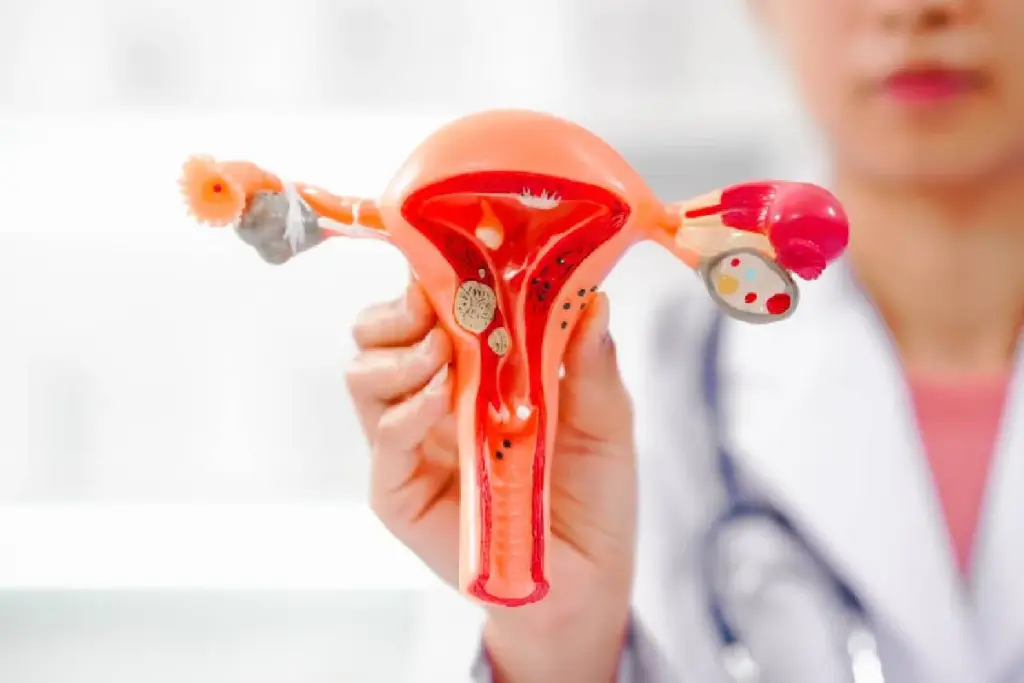 Understanding Adenomyosis: Causes, Symptoms, and Diagnosis