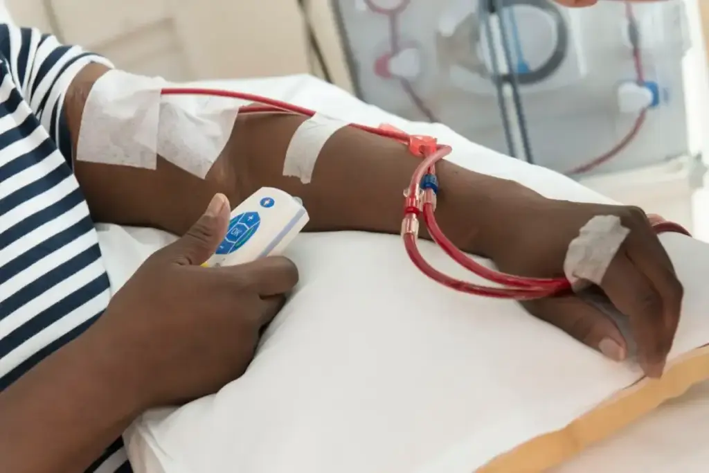 Graft For Dialysis: Amazing Ways To Stop Bleeding