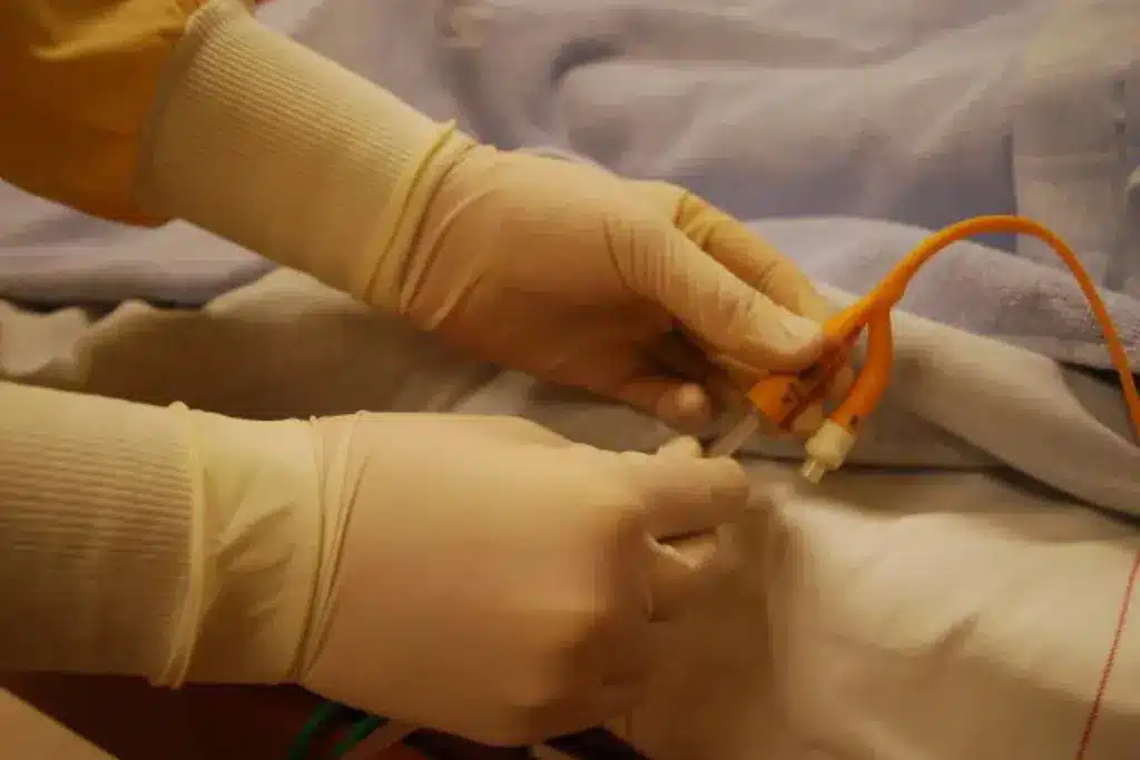 Causes of Post-Dialysis Bleeding