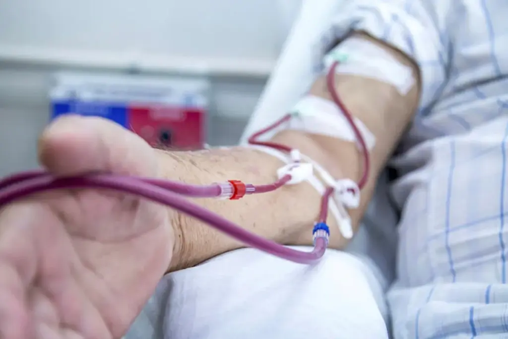 The Critical Role of CRRT in Acute Kidney Injury Management