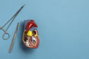 Heart Failure Surgery: Vital Amazing Facts