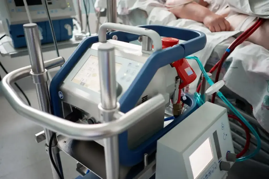 What is ECMO and How Does It Support the Heart