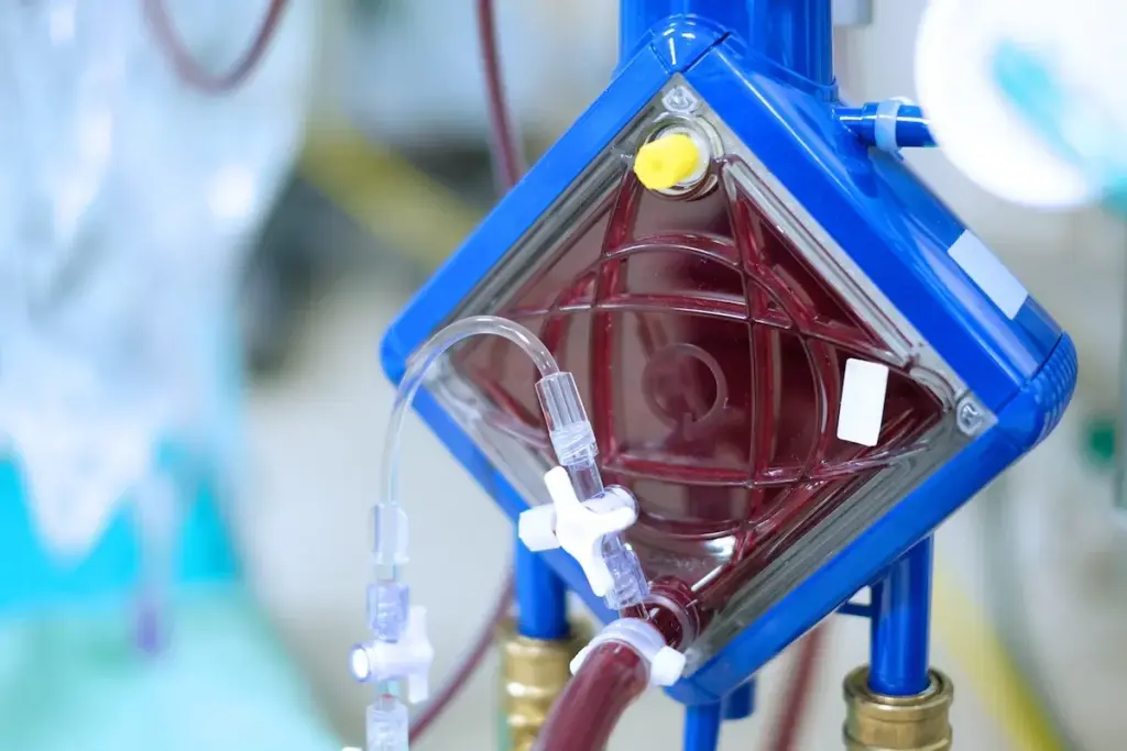 Ecmo: Amazing Differences From Ventilators 3 How Mechanical Ventilators Work
