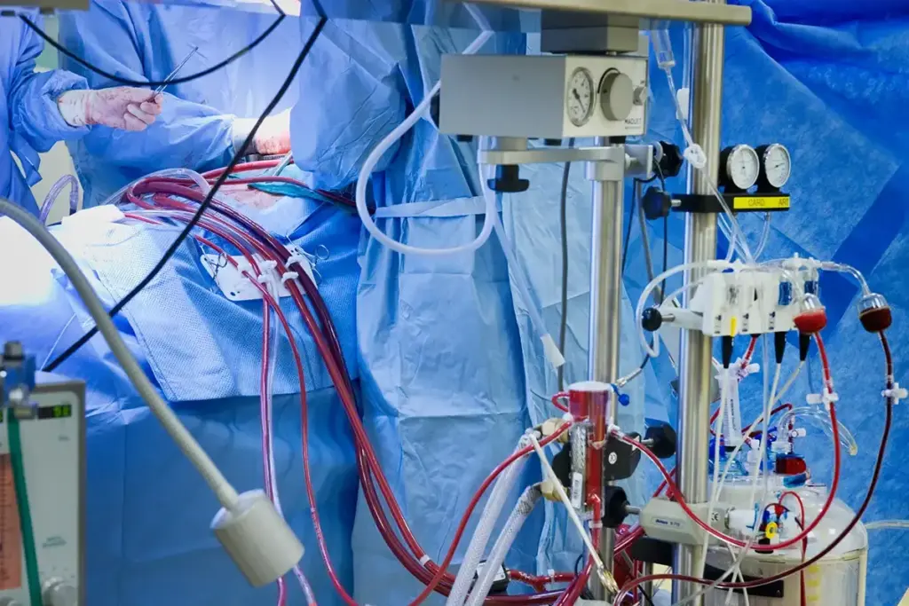 What Is ECMO and How Does It Support Critical Patients?