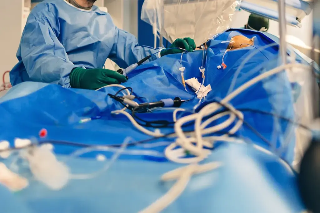 Bypass Machine Heart: Vital Amazing Comfort 3 Measuring Pain After Heart Surgery