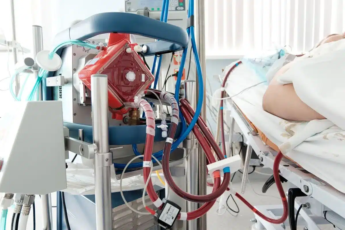 Perfusion Medical Definition: Vital Facts
