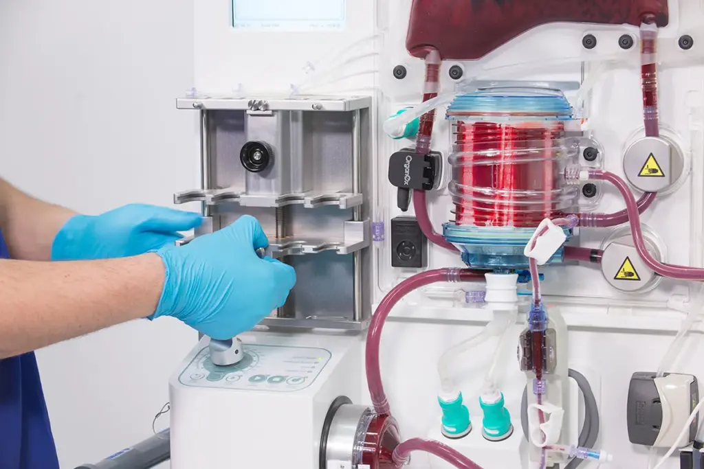 Perfusion Medical Definition: Vital Facts