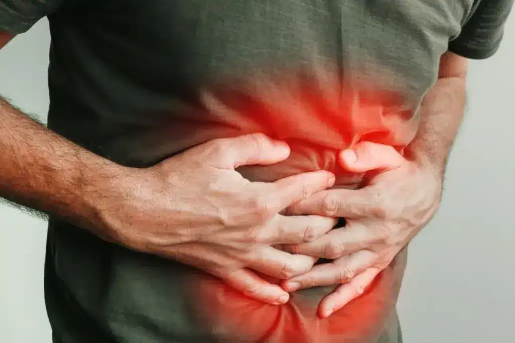 Understanding Hernias: Definition and Basic Concepts