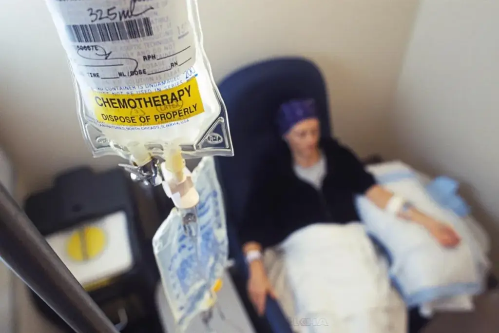 How Long After Chemo Do You Die? Best Facts
