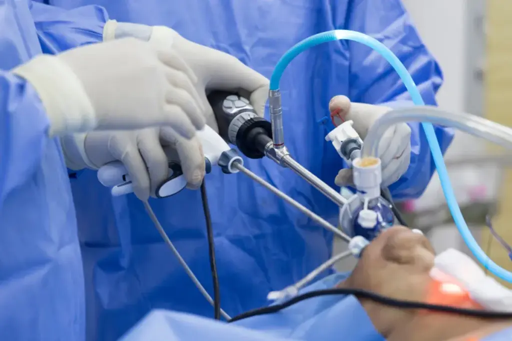 How To Shrink Thyroid Nodules Without Surgery 2 SEP 7309 image 2 LIV Hospital