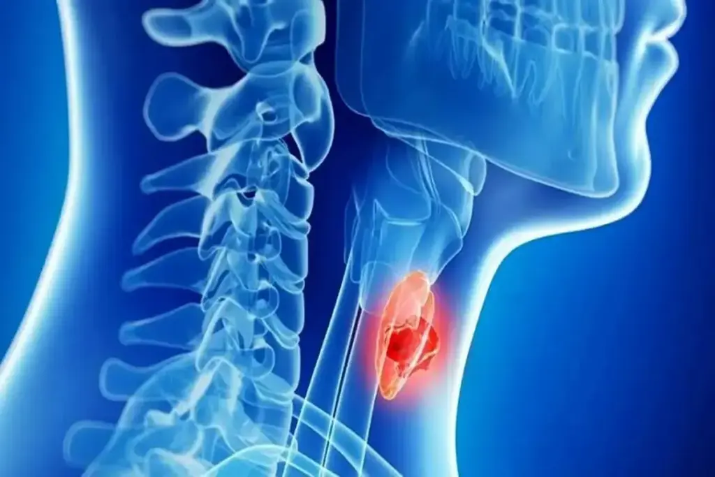 Understanding Thyroid Nodules