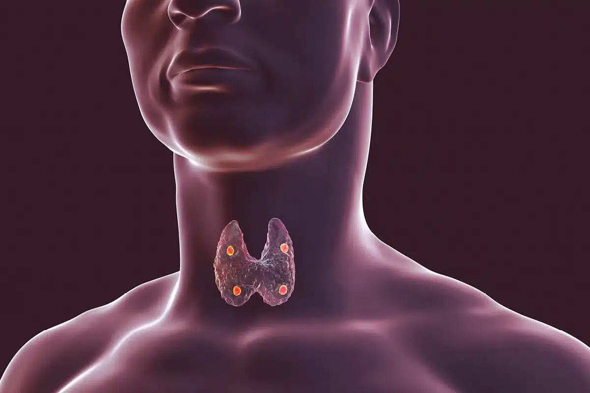 Thyroidectomy: Best Guide To Big Facts