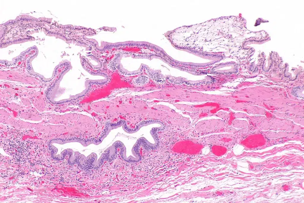 Common Reasons for Hepatobiliary Referrals