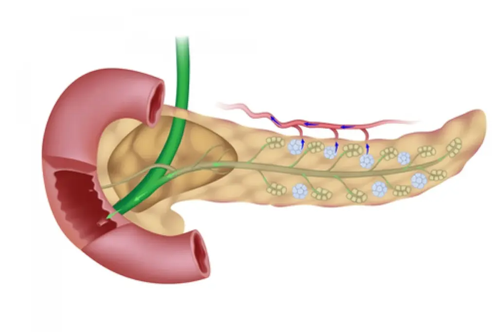 Identifying Blocked Bile Duct Stool: Color and Appearance